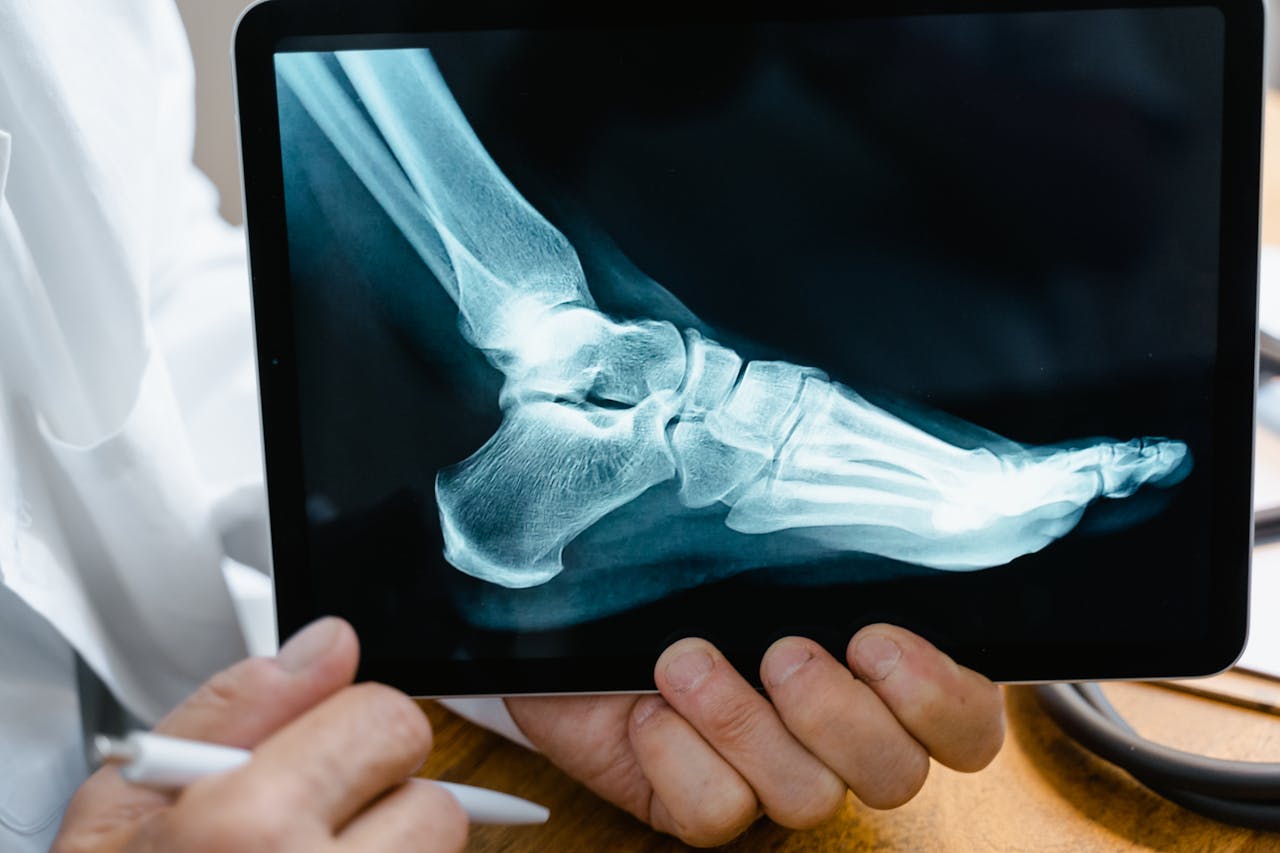 Ankle Injury Compensation Victoria