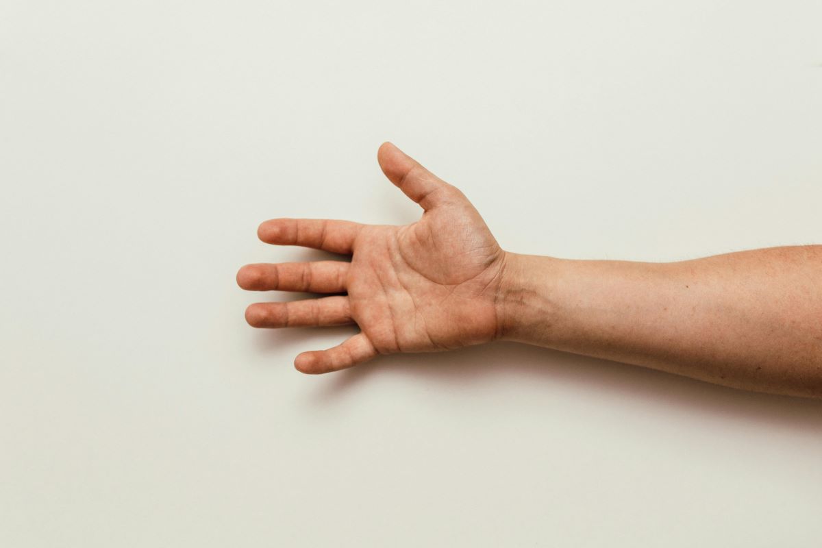 Hand Injury Compensation